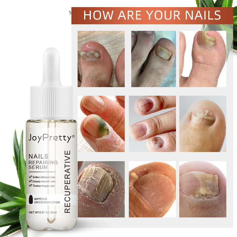 Nourishing Nails Repairing Serum