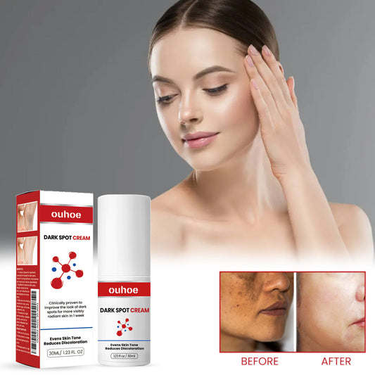 Black Spots Repair Cream