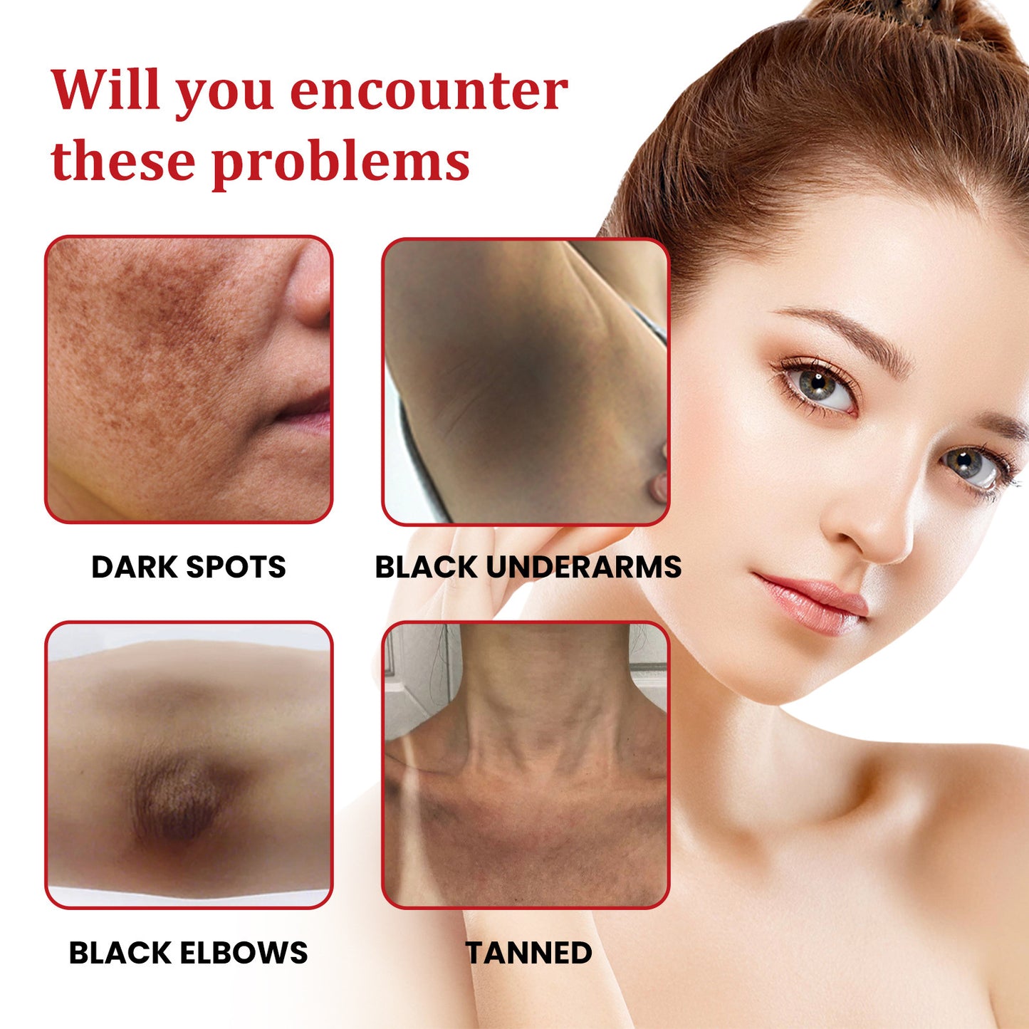 Black Spots Repair Cream