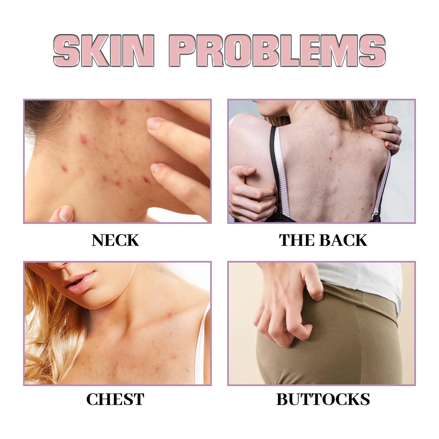 Chest & Back Cleansing Fade Acne Print Skin Care Ball