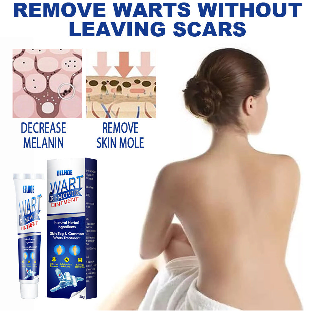 Wart Removing Cream
